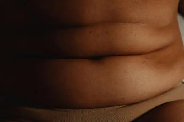 The Hidden Connection: How Stress Shapes Your Fitness and Body Composition 3 image of what stress can do on the stomach area and how Lipo 360 Horley can help to change your body shape.